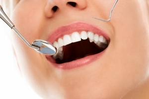 Strengthen Your Oral Health with Braces